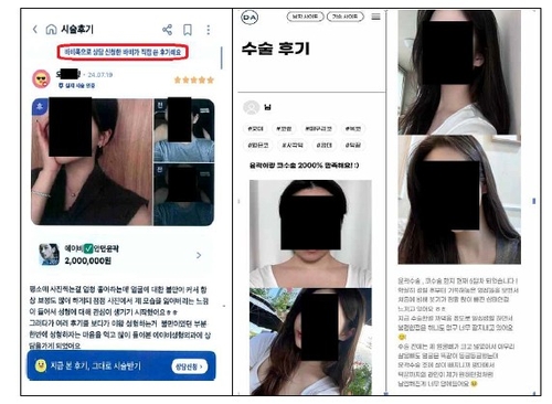 모바일 앱 및 병원 홈페이지 후기 광고 예시